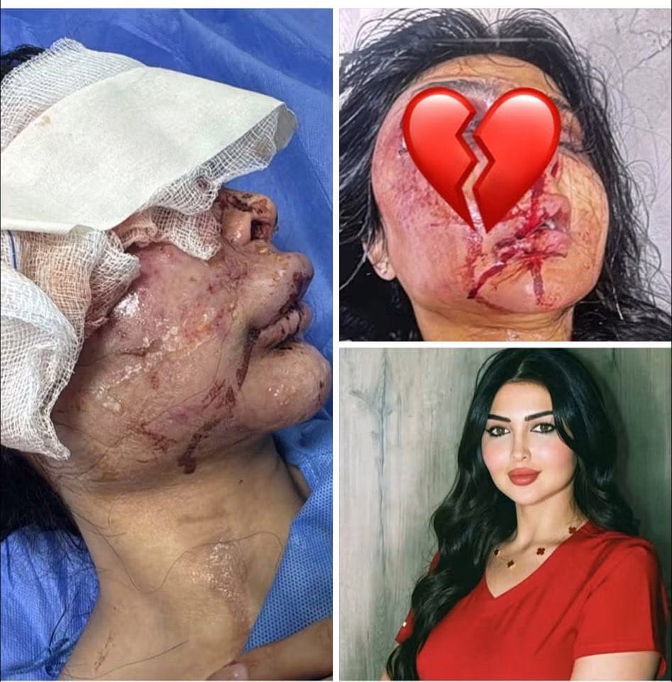 حادثة الدكتورة فيروزة في العراق